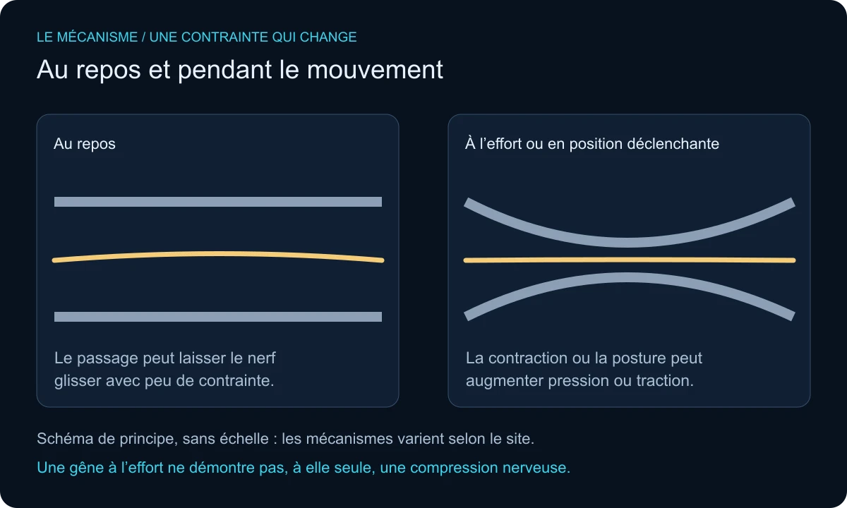 Comparaison schématique d’un passage nerveux au repos et lors d’une contrainte liée au mouvement.