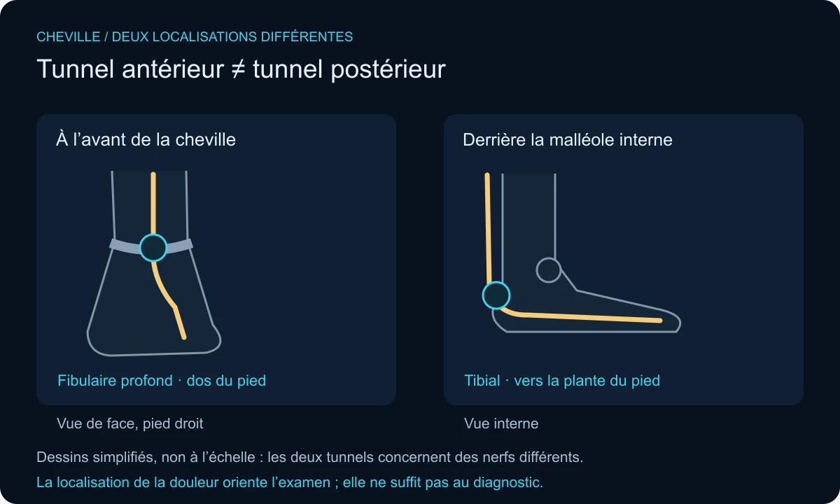 Deux vues comparées : fibulaire profond à l’avant de la cheville ; tibial derrière la malléole interne, vers la plante.